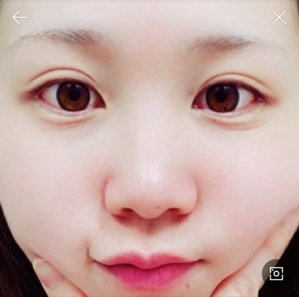 일본인우라라
