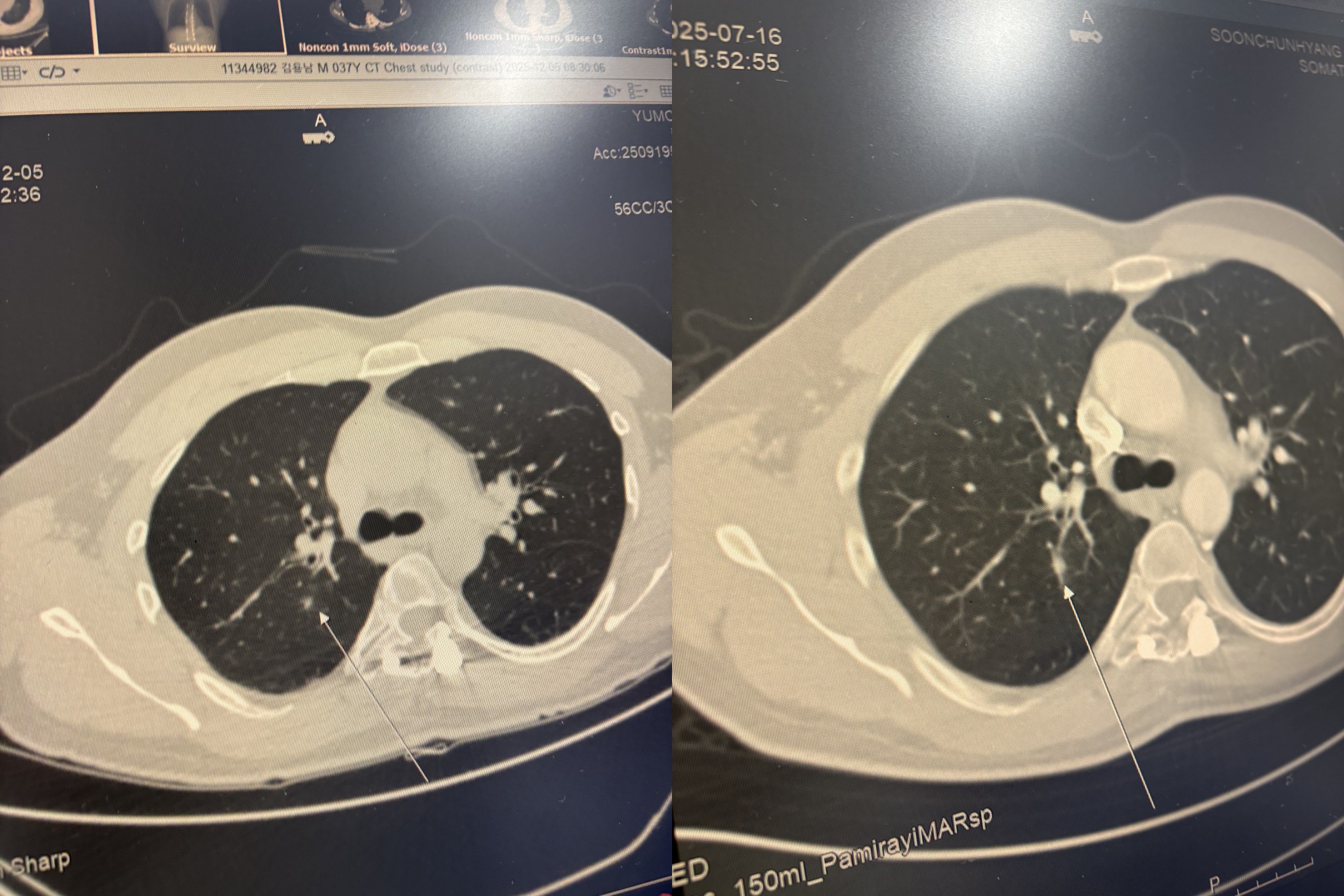 용느님의 방송국 | SOOP